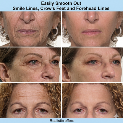 Metadermic™ Instant Face Temporary Tightener – Instant visible results in 30 seconds