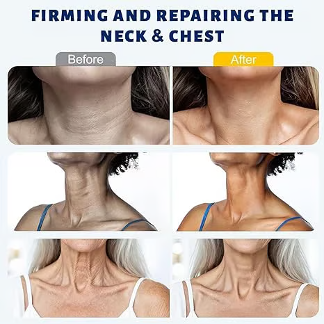 ROVINAO™ Roller Massage Neck Cream 🧴 Collagen & Hyaluronic Acid | Firms Neck, Reduces Wrinkles & Double Chin