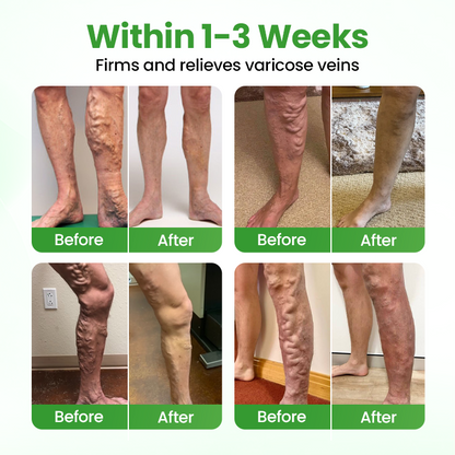 Tenviro® VeinHeal Microneedle Patch