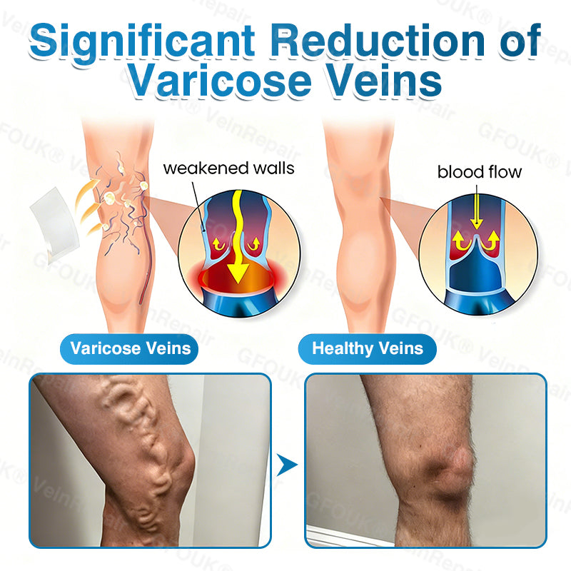 🇨🇦🏆✅️🏃ROVINAO® VeinRepair Microneedle Patch Roll⚡Instant Relief, Long-Term Results