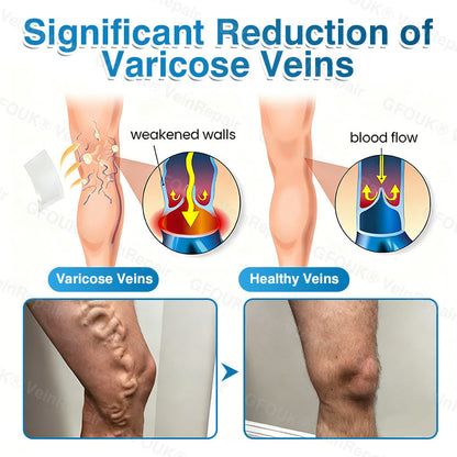 🇨🇦🏆✅️🏃ROVINAO® VeinRepair Microneedle Patch Roll⚡Instant Relief, Long-Term Results