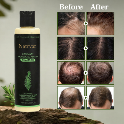 🔥Flash Sale 5K+ SOLD!✨🌱 Organic Rosemary Hair Growth Shampoo