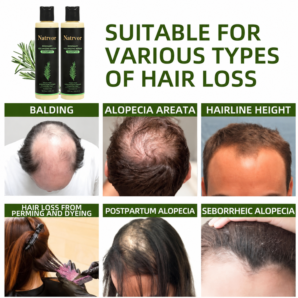 🔥Flash Sale 5K+ SOLD!✨🌱 Organic Rosemary Hair Growth Shampoo