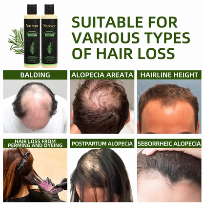 🔥Flash Sale 5K+ SOLD!✨🌱 Organic Rosemary Hair Growth Shampoo