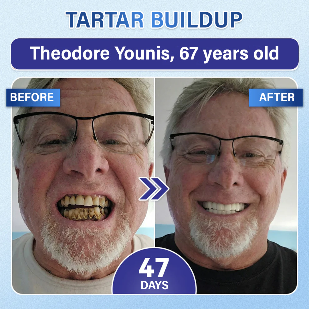Your Smile🦷Ceoerty® Tooth & Gum Repair Fast-Dissolving Microneedle Patch✨ (𝟓-𝐢𝐧-𝟏 💎 𝐑𝐞𝐛𝐮𝐢𝐥𝐝 𝐄𝐧𝐚𝐦𝐞𝐥 & 𝐃𝐞𝐧𝐭𝐢𝐧 • 𝐒𝐭𝐫𝐞𝐧𝐠𝐭𝐡𝐞𝐧 𝐆𝐮𝐦𝐬 • 𝐄𝐫𝐚𝐝𝐢𝐜𝐚𝐭𝐞 𝐓𝐚𝐫𝐭𝐚𝐫 & 𝐎𝐝𝐨𝐫 • 𝐖𝐡𝐢𝐭𝐞𝐧𝐢𝐧𝐠 • 𝐒𝐭𝐨𝐩 𝐓𝐨𝐨𝐭𝐡 𝐒𝐞𝐧𝐬𝐢𝐭𝐢𝐯𝐢𝐭𝐲)🔥
