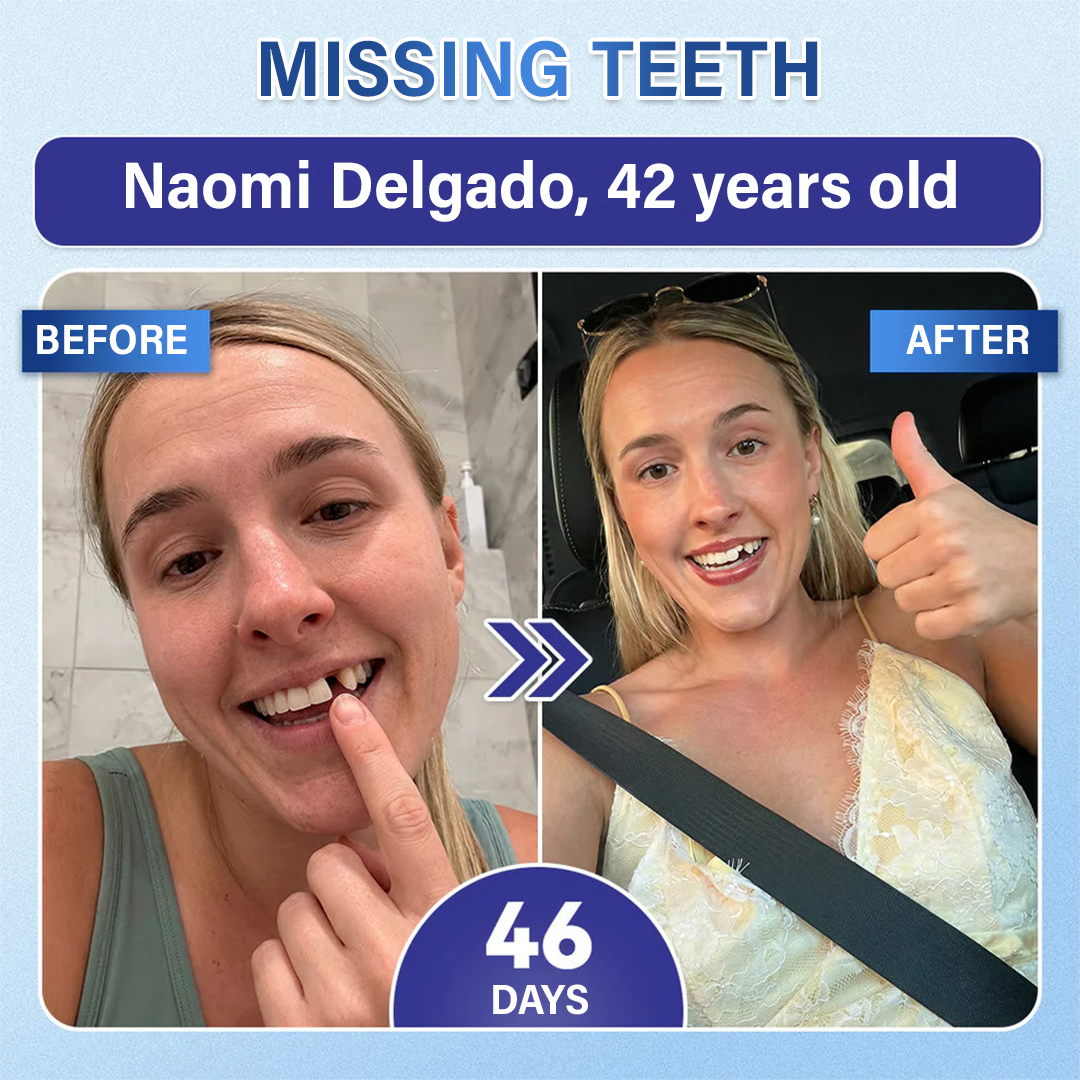 Your Smile🦷Ceoerty® Tooth & Gum Repair Fast-Dissolving Microneedle Patch✨ (𝟓-𝐢𝐧-𝟏 💎 𝐑𝐞𝐛𝐮𝐢𝐥𝐝 𝐄𝐧𝐚𝐦𝐞𝐥 & 𝐃𝐞𝐧𝐭𝐢𝐧 • 𝐒𝐭𝐫𝐞𝐧𝐠𝐭𝐡𝐞𝐧 𝐆𝐮𝐦𝐬 • 𝐄𝐫𝐚𝐝𝐢𝐜𝐚𝐭𝐞 𝐓𝐚𝐫𝐭𝐚𝐫 & 𝐎𝐝𝐨𝐫 • 𝐖𝐡𝐢𝐭𝐞𝐧𝐢𝐧𝐠 • 𝐒𝐭𝐨𝐩 𝐓𝐨𝐨𝐭𝐡 𝐒𝐞𝐧𝐬𝐢𝐭𝐢𝐯𝐢𝐭𝐲)🔥