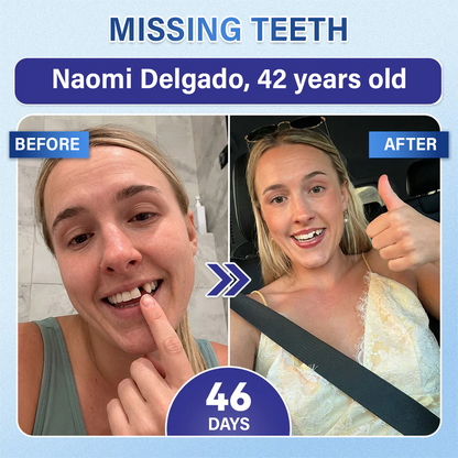 Your Smile🦷Ceoerty® Tooth & Gum Repair Fast-Dissolving Microneedle Patch✨ (𝟓-𝐢𝐧-𝟏 💎 𝐑𝐞𝐛𝐮𝐢𝐥𝐝 𝐄𝐧𝐚𝐦𝐞𝐥 & 𝐃𝐞𝐧𝐭𝐢𝐧 • 𝐒𝐭𝐫𝐞𝐧𝐠𝐭𝐡𝐞𝐧 𝐆𝐮𝐦𝐬 • 𝐄𝐫𝐚𝐝𝐢𝐜𝐚𝐭𝐞 𝐓𝐚𝐫𝐭𝐚𝐫 & 𝐎𝐝𝐨𝐫 • 𝐖𝐡𝐢𝐭𝐞𝐧𝐢𝐧𝐠 • 𝐒𝐭𝐨𝐩 𝐓𝐨𝐨𝐭𝐡 𝐒𝐞𝐧𝐬𝐢𝐭𝐢𝐯𝐢𝐭𝐲)🔥