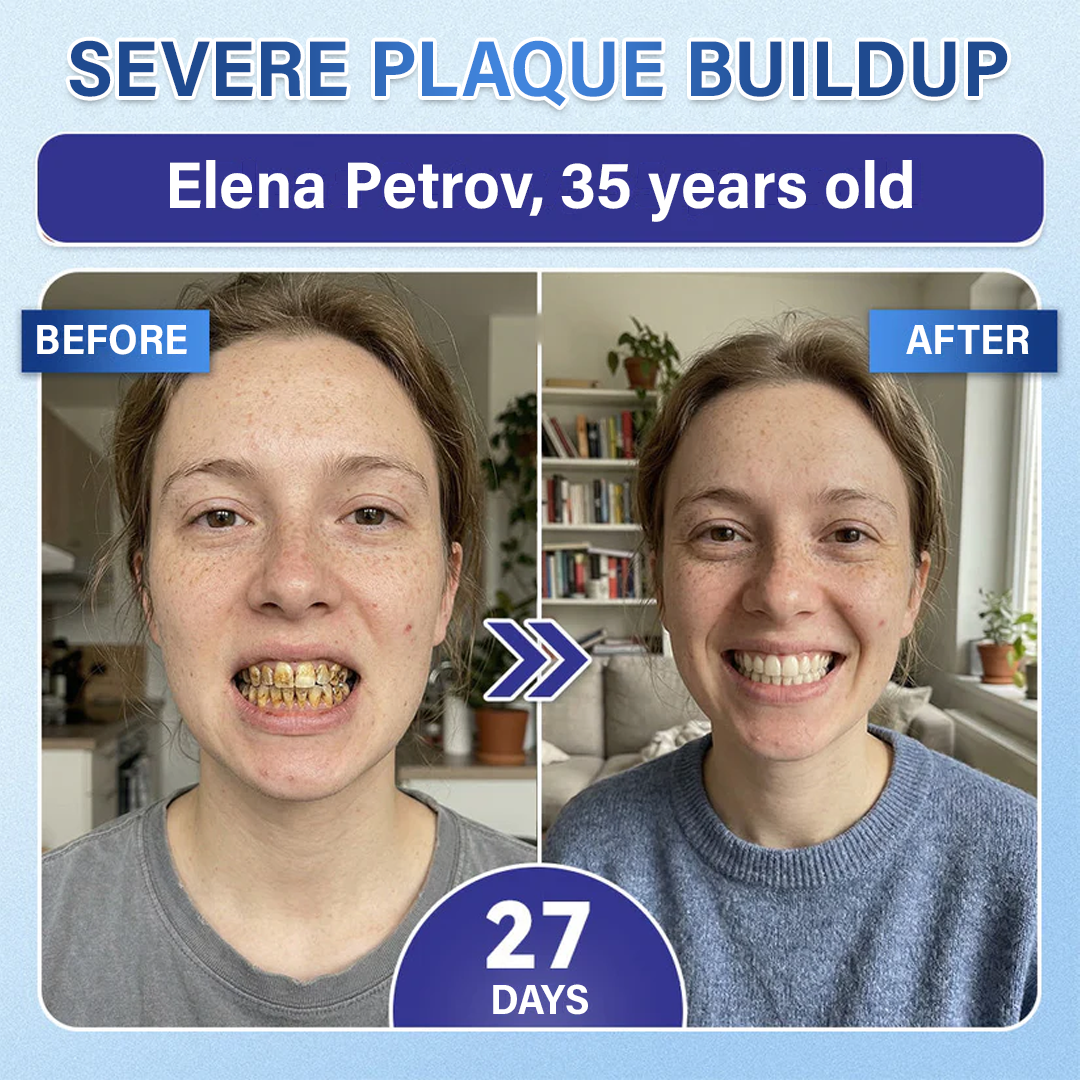 Your Smile🦷Ceoerty® Tooth & Gum Repair Fast-Dissolving Microneedle Patch✨ (𝟓-𝐢𝐧-𝟏 💎 𝐑𝐞𝐛𝐮𝐢𝐥𝐝 𝐄𝐧𝐚𝐦𝐞𝐥 & 𝐃𝐞𝐧𝐭𝐢𝐧 • 𝐒𝐭𝐫𝐞𝐧𝐠𝐭𝐡𝐞𝐧 𝐆𝐮𝐦𝐬 • 𝐄𝐫𝐚𝐝𝐢𝐜𝐚𝐭𝐞 𝐓𝐚𝐫𝐭𝐚𝐫 & 𝐎𝐝𝐨𝐫 • 𝐖𝐡𝐢𝐭𝐞𝐧𝐢𝐧𝐠 • 𝐒𝐭𝐨𝐩 𝐓𝐨𝐨𝐭𝐡 𝐒𝐞𝐧𝐬𝐢𝐭𝐢𝐯𝐢𝐭𝐲)🔥