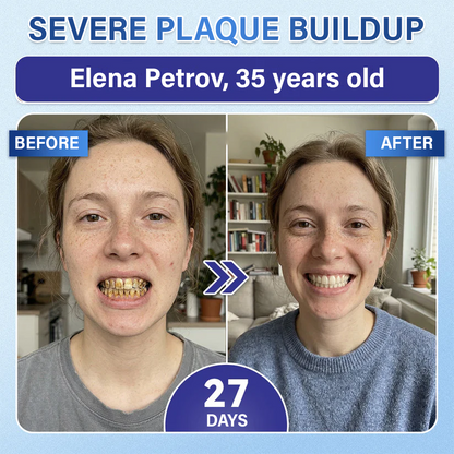 Your Smile🦷Ceoerty® Tooth & Gum Repair Fast-Dissolving Microneedle Patch✨ (𝟓-𝐢𝐧-𝟏 💎 𝐑𝐞𝐛𝐮𝐢𝐥𝐝 𝐄𝐧𝐚𝐦𝐞𝐥 & 𝐃𝐞𝐧𝐭𝐢𝐧 • 𝐒𝐭𝐫𝐞𝐧𝐠𝐭𝐡𝐞𝐧 𝐆𝐮𝐦𝐬 • 𝐄𝐫𝐚𝐝𝐢𝐜𝐚𝐭𝐞 𝐓𝐚𝐫𝐭𝐚𝐫 & 𝐎𝐝𝐨𝐫 • 𝐖𝐡𝐢𝐭𝐞𝐧𝐢𝐧𝐠 • 𝐒𝐭𝐨𝐩 𝐓𝐨𝐨𝐭𝐡 𝐒𝐞𝐧𝐬𝐢𝐭𝐢𝐯𝐢𝐭𝐲)🔥