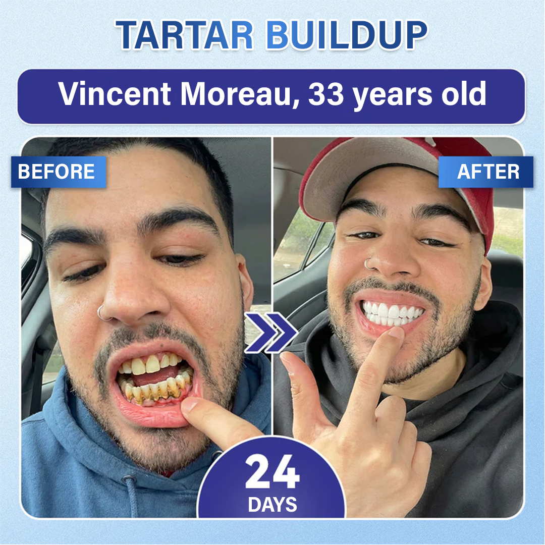 Your Smile🦷Ceoerty® Tooth & Gum Repair Fast-Dissolving Microneedle Patch✨ (𝟓-𝐢𝐧-𝟏 💎 𝐑𝐞𝐛𝐮𝐢𝐥𝐝 𝐄𝐧𝐚𝐦𝐞𝐥 & 𝐃𝐞𝐧𝐭𝐢𝐧 • 𝐒𝐭𝐫𝐞𝐧𝐠𝐭𝐡𝐞𝐧 𝐆𝐮𝐦𝐬 • 𝐄𝐫𝐚𝐝𝐢𝐜𝐚𝐭𝐞 𝐓𝐚𝐫𝐭𝐚𝐫 & 𝐎𝐝𝐨𝐫 • 𝐖𝐡𝐢𝐭𝐞𝐧𝐢𝐧𝐠 • 𝐒𝐭𝐨𝐩 𝐓𝐨𝐨𝐭𝐡 𝐒𝐞𝐧𝐬𝐢𝐭𝐢𝐯𝐢𝐭𝐲)🔥