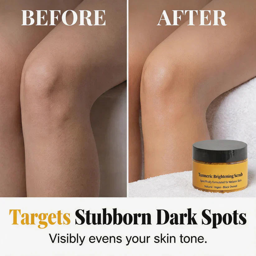 🔥Last Day Buy 1 Get 1 Free ✨Turmeric Exfoliating Body Scrub