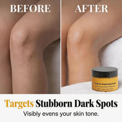 🔥Last Day Buy 1 Get 1 Free ✨Turmeric Exfoliating Body Scrub