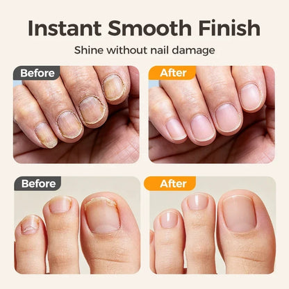 🔥Last Day 50% OFF -✂️ 2-in-1 Smart Electric Nail Clipper & Polisher – Anti-Pinch Safety & LED Light 💅