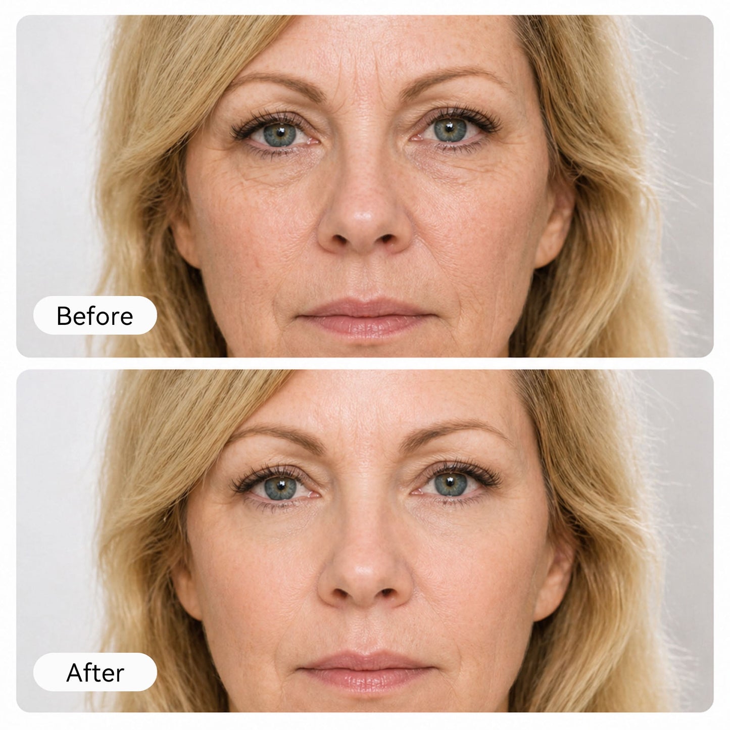 Rovinao EGF Firming Serum