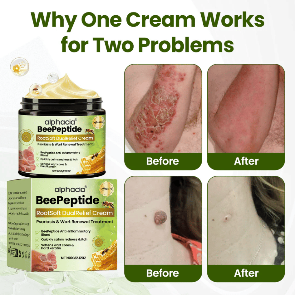 ✅Alphacia® BeePeptide RootSoft DualRelief Cream⚕️ ( Buy 1 Get 1 Free)