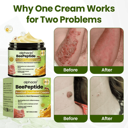 ✅Alphacia® BeePeptide RootSoft DualRelief Cream⚕️ ( Buy 1 Get 1 Free)