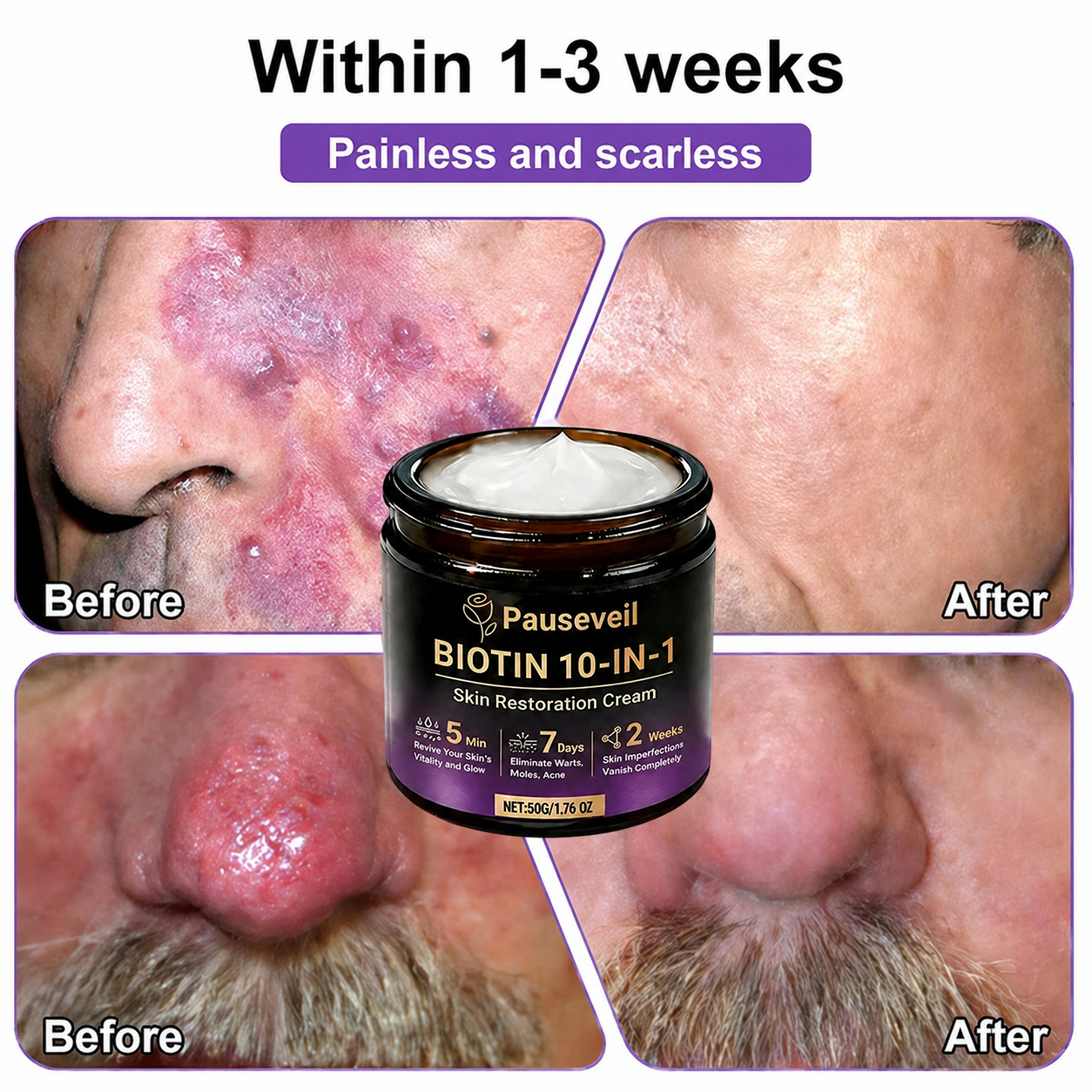 Made and Shipped from USA✨Pauseveil® Biotin 10-in-1 Skin Restoration Cream🍀