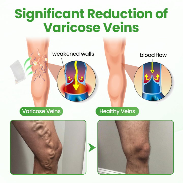 Tenviro® VeinHeal Microneedle Patch