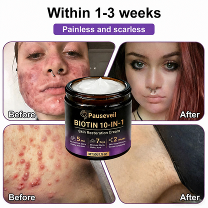 Made and Shipped from USA✨Pauseveil® Biotin 10-in-1 Skin Restoration Cream🍀