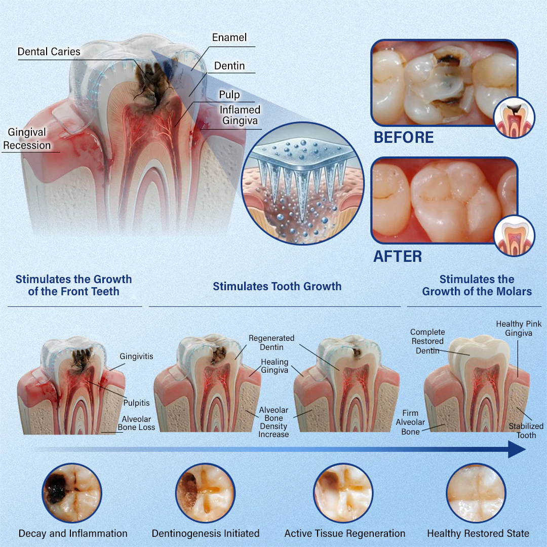 Your Smile🦷Ceoerty® Tooth & Gum Repair Fast-Dissolving Microneedle Patch✨ (𝟓-𝐢𝐧-𝟏 💎 𝐑𝐞𝐛𝐮𝐢𝐥𝐝 𝐄𝐧𝐚𝐦𝐞𝐥 & 𝐃𝐞𝐧𝐭𝐢𝐧 • 𝐒𝐭𝐫𝐞𝐧𝐠𝐭𝐡𝐞𝐧 𝐆𝐮𝐦𝐬 • 𝐄𝐫𝐚𝐝𝐢𝐜𝐚𝐭𝐞 𝐓𝐚𝐫𝐭𝐚𝐫 & 𝐎𝐝𝐨𝐫 • 𝐖𝐡𝐢𝐭𝐞𝐧𝐢𝐧𝐠 • 𝐒𝐭𝐨𝐩 𝐓𝐨𝐨𝐭𝐡 𝐒𝐞𝐧𝐬𝐢𝐭𝐢𝐯𝐢𝐭𝐲)🔥