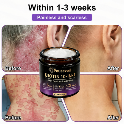 Made and Shipped from USA✨Pauseveil® Biotin 10-in-1 Skin Restoration Cream🍀