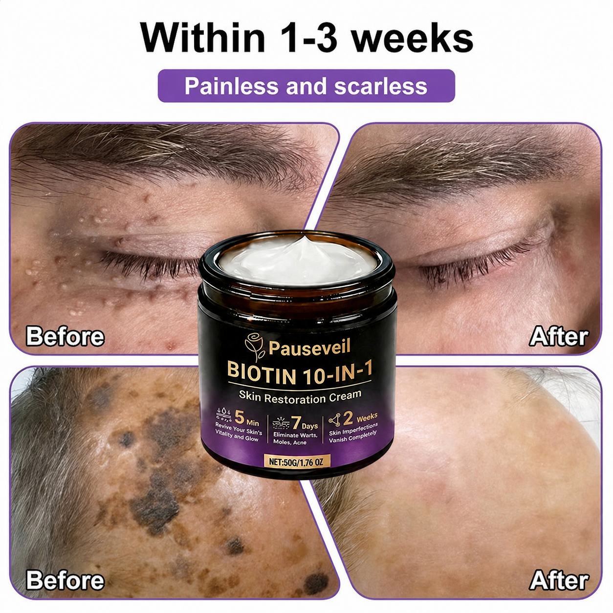 Made and Shipped from USA✨Pauseveil® Biotin 10-in-1 Skin Restoration Cream🍀