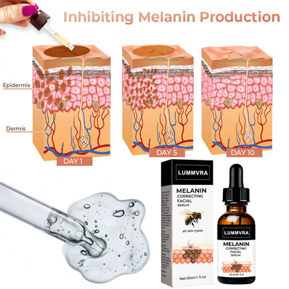 ✨Fast Dark Spot Remover-Lummvra™  Melanin Correcting Facial Serum(🔥Last Day Promotion 60% OFF)