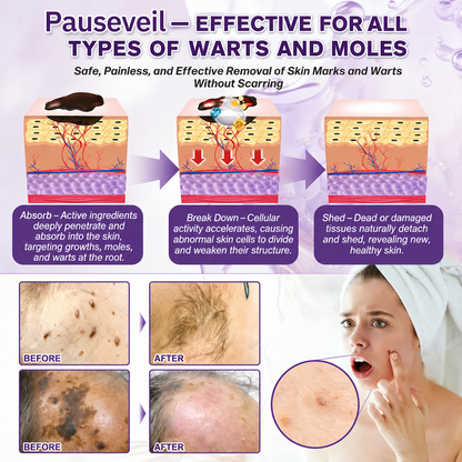 Made and Shipped from USA✨Pauseveil® Biotin 10-in-1 Skin Restoration Cream🍀