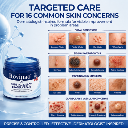 Rovinao® 7-Day Skin Tag & Spot Eraser Cream