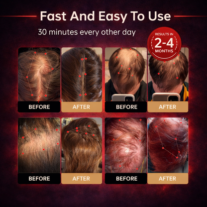 Red Light Therapy Regrowth Cap