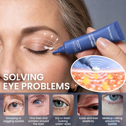 ROVINAO® Lid Lifting Treatment