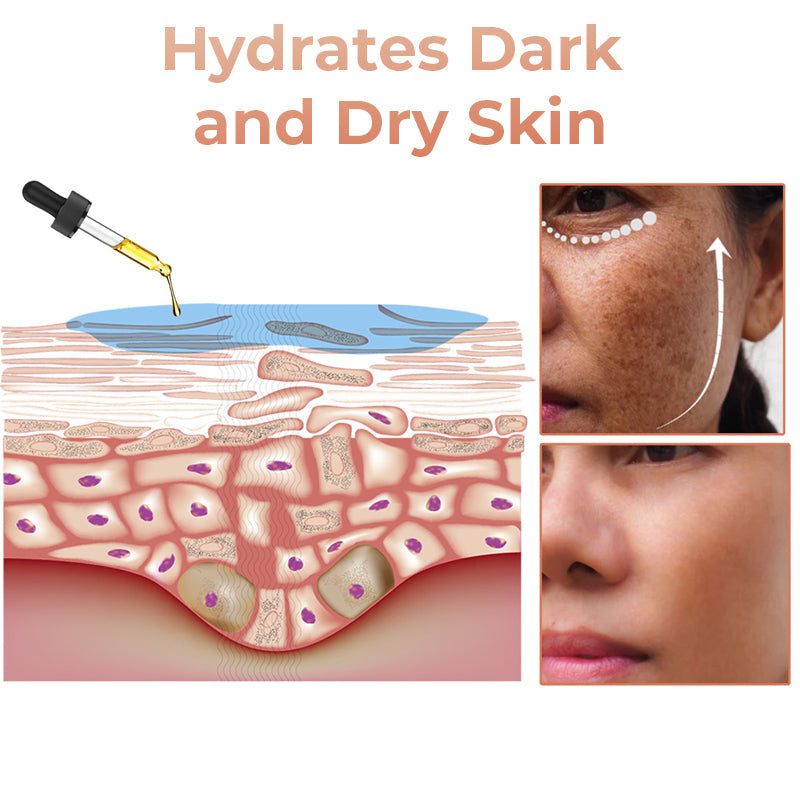 ✨Fast Dark Spot Remover-Lummvra™  Melanin Correcting Facial Serum(🔥Last Day Promotion 60% OFF)