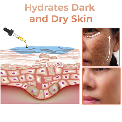 ✨Fast Dark Spot Remover-Lummvra™  Melanin Correcting Facial Serum(🔥Last Day Promotion 60% OFF)