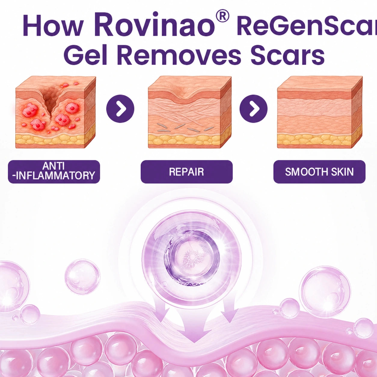 How Rovinao ReGenScar supports scar appearance
