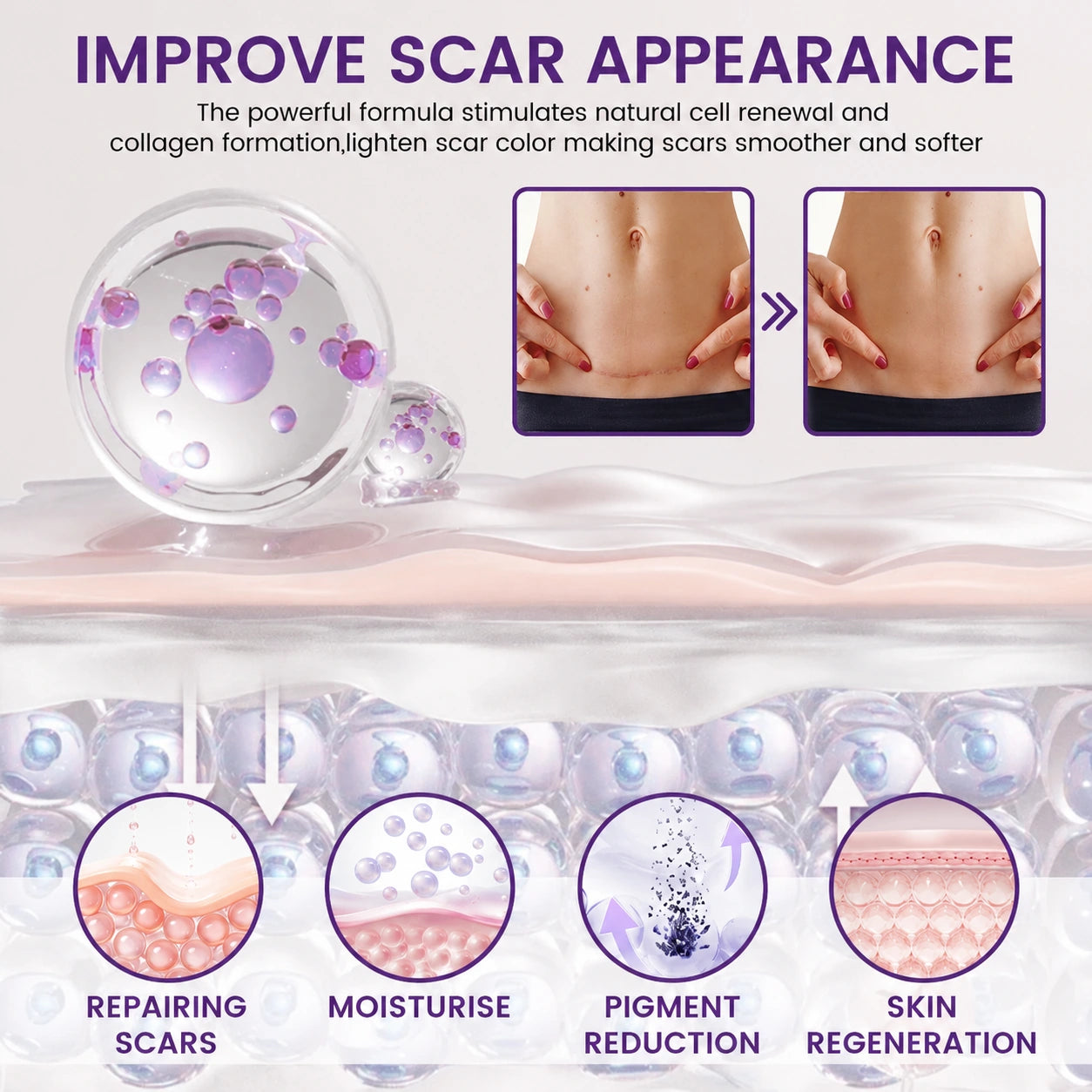 Rovinao ReGenScar visible scar appearance support